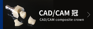 CAD-CAM冠